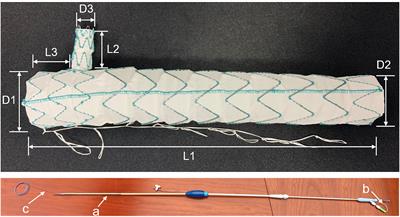 Single-center experience with a unibody single-branched stent graft for zone 2 thoracic endovascular aortic repair